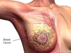 乳腺癌患者需要补充营养素有哪些？