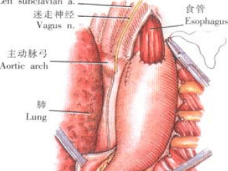 食管癌的術后護理