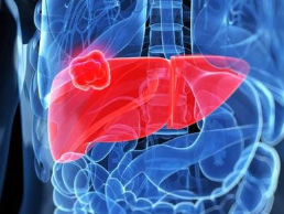原发性肝癌的症状表现主要有哪些？