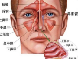 鼻炎與鼻竇炎的差別