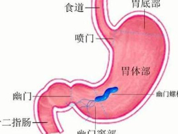 免費(fèi)治療 解決胃癌患者經(jīng)濟(jì)之憂