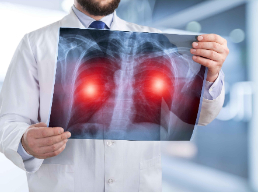 肺癌的早期征兆有哪些？